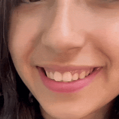 SMILEFIT PRO – ΡΥΘΜΙΖΟΜΕΝΟ ΣΕΤ ΔΟΝΤΙΩΝ ΓΙΑ ΤΕΛΕΙΟ ΧΑΜΟΓΕΛΟ